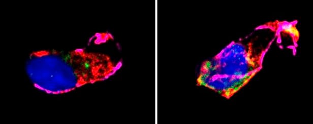 충분히 수면한 사람의 심혈관 세포(왼쪽)와 만성적으로 수면을 제한한 후의 세포 모습(오른쪽). 산화 물질이 세포에 축적되면 세포 인자 NRF2가 일반적으로 세포 핵(사진상 파란색)으로 이동해 항산화 반응을 일으켜야 하는데 수면이 제한된 경우 NRF2(사진상 노란색)가 핵으로 이동하지 못하고 퍼져있는 것을 볼 수 있다. /콜럼비아 대학교 어빙 의학 센터 제공