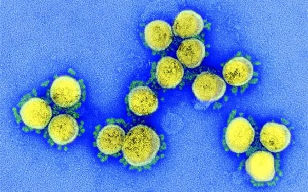 코로나 바이러스의 전자현미경 사진. 바이러스는 표면의 돌기(스파이크)로 세포에 결합하는데 면역체계가 만드는 항체는 이 돌기에 먼저 결합해 바이러스를 무력화시킨다.