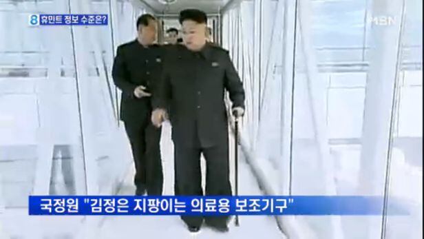 김정은이 2014년 무렵 절뚝 거리며 지팡이를 짚고 걷는 모습.