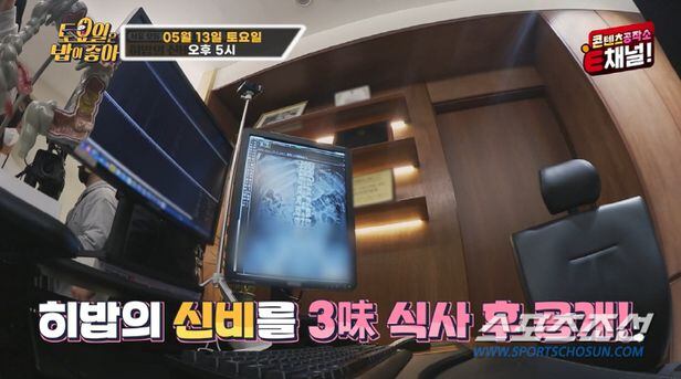 먹방 유튜버' 히밥, 위 크기가 '신비'…의사 
