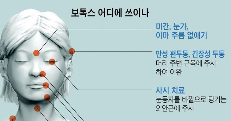 가격 2만원까지 떨어지자… 화장하듯 맞는 보톡스 - 조선일보