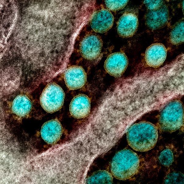 코로나 바이러스의 전자현미경 사진. 왕관 모양으로 표면에 나있는 돌기(스파이크) 단백질을 숙주세포에 결합시켜 침입한다. /NIAID
