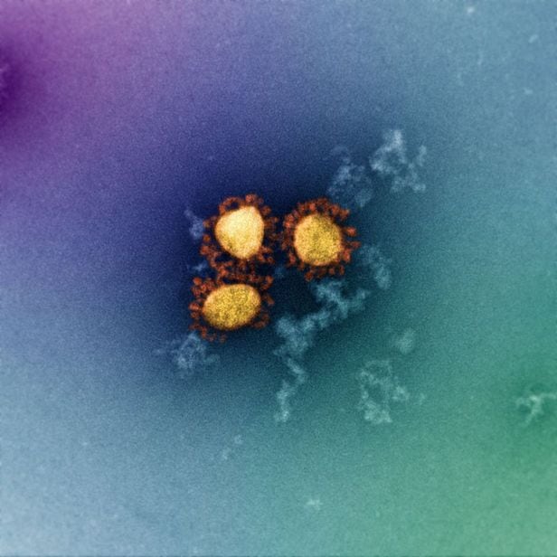 오미크론 변이 코로나 바이러스(노란색)의 전자현미경 사진./호주 멜버른대 도허티 연구소