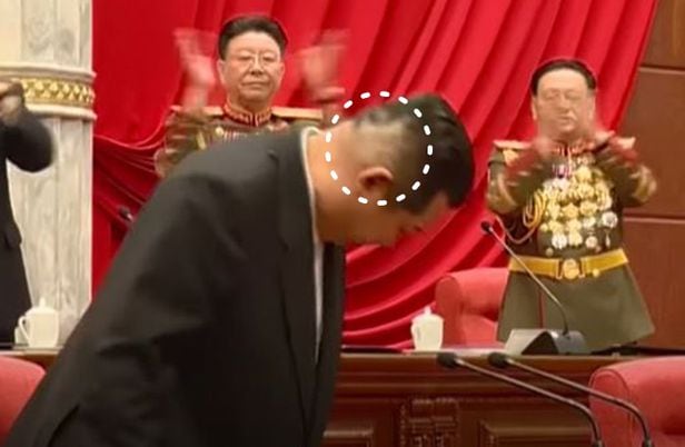 북한 김정은 국무위원장이 지난주 8기 4차 전원회의를 주재하는 모습. 오른쪽 뒤통수에 의료용 테이프를 붙였다 뗀 자국이 보인다. /조선중앙TV