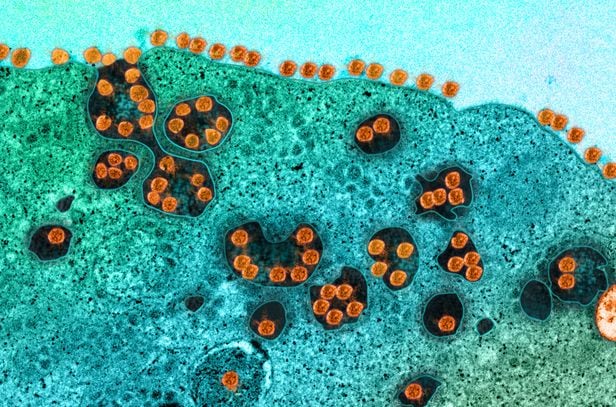 원숭이 세포에 침투한 오미크론 변이 바이러스(주황색). 표면 스파이크 단백질에 돌연변이가 많이 일어나 항체 공격을 잘 피하는 것으로 나타났다./홍콩대
