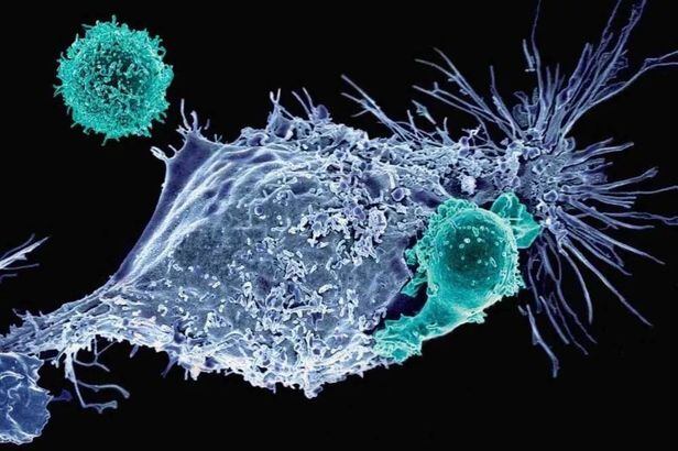 CAR-T세포(녹색)이 암세포(파란색)을 공격하는 모습./미 메모리얼 슬로언 케터링 암센터